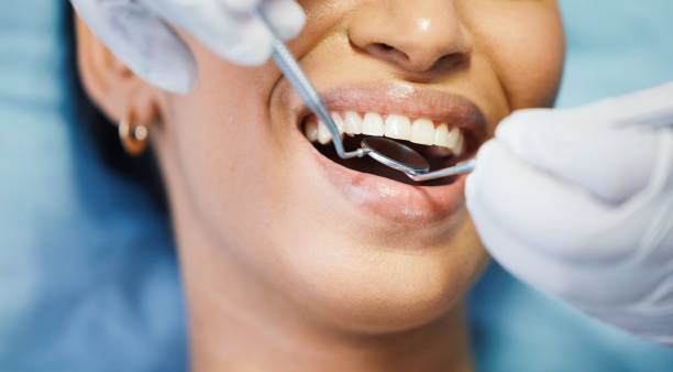 Best Dentist for Dental Trauma  in Mount Shasta, CA
