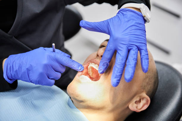 Best Knocked-Out Tooth Emergency  in Mount Shasta, CA